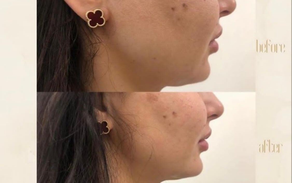 صورة توضيحية - مركز Dermanda Clinic التجميلي ريادة في تقديم العلاجات الآمنة للمشاكل الجلدية