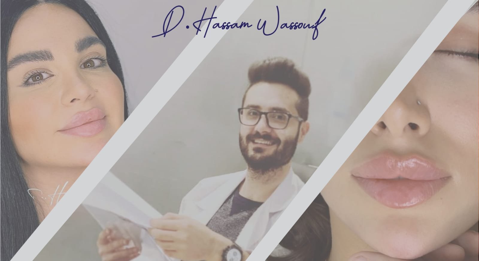 صورة توضيحية - الدكتور حسام الوسوف بأسلوب في الجراحة التجميلية